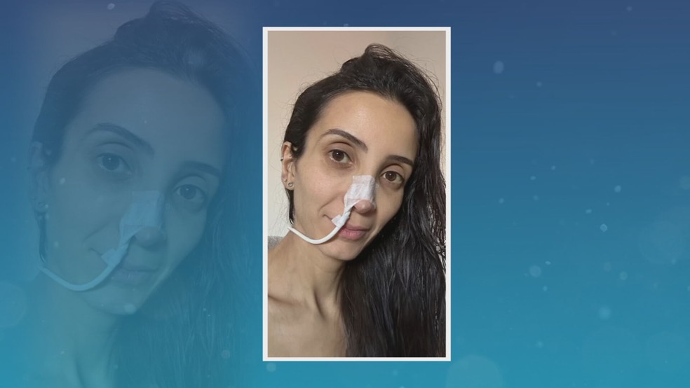 Mayara Corrêa precisou de transplante de fígado por causa de uma doença autoimune chamada colangite — Foto: Reprodução/TV TEM