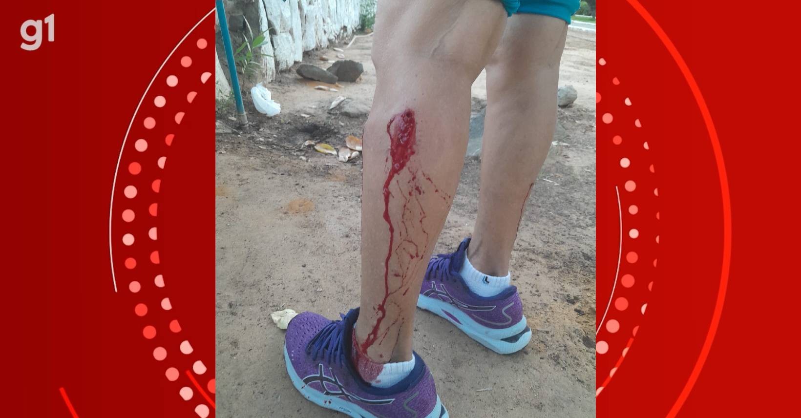 Ataques de cães em Petrolina assustam moradores; idosa é mordida no Parque Josepha Coelho