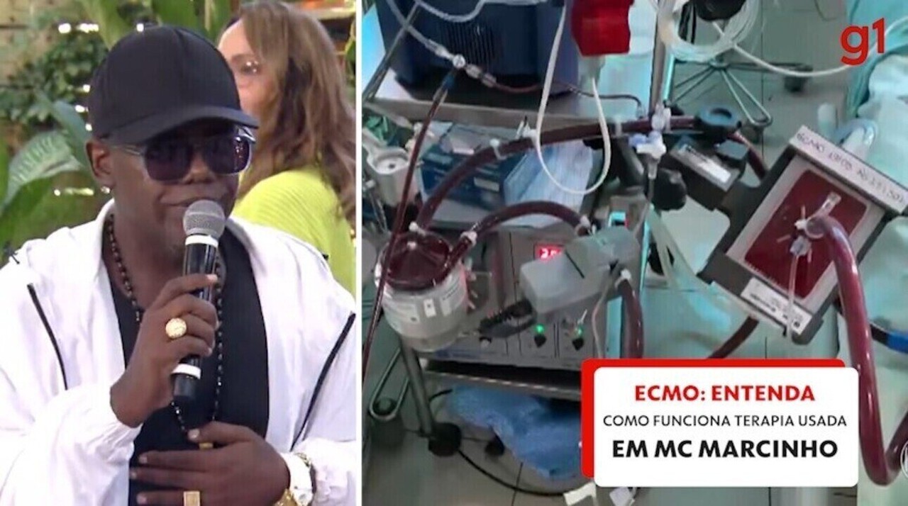 MC Marcinho usa terapia conhecida como ECMO, espécie de pulmão artificial