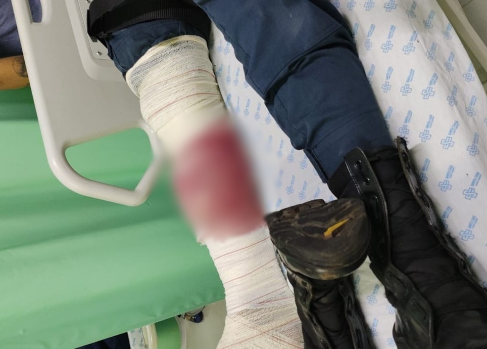 PM teve uma fratura na perna após confusão — Foto: Reprodução