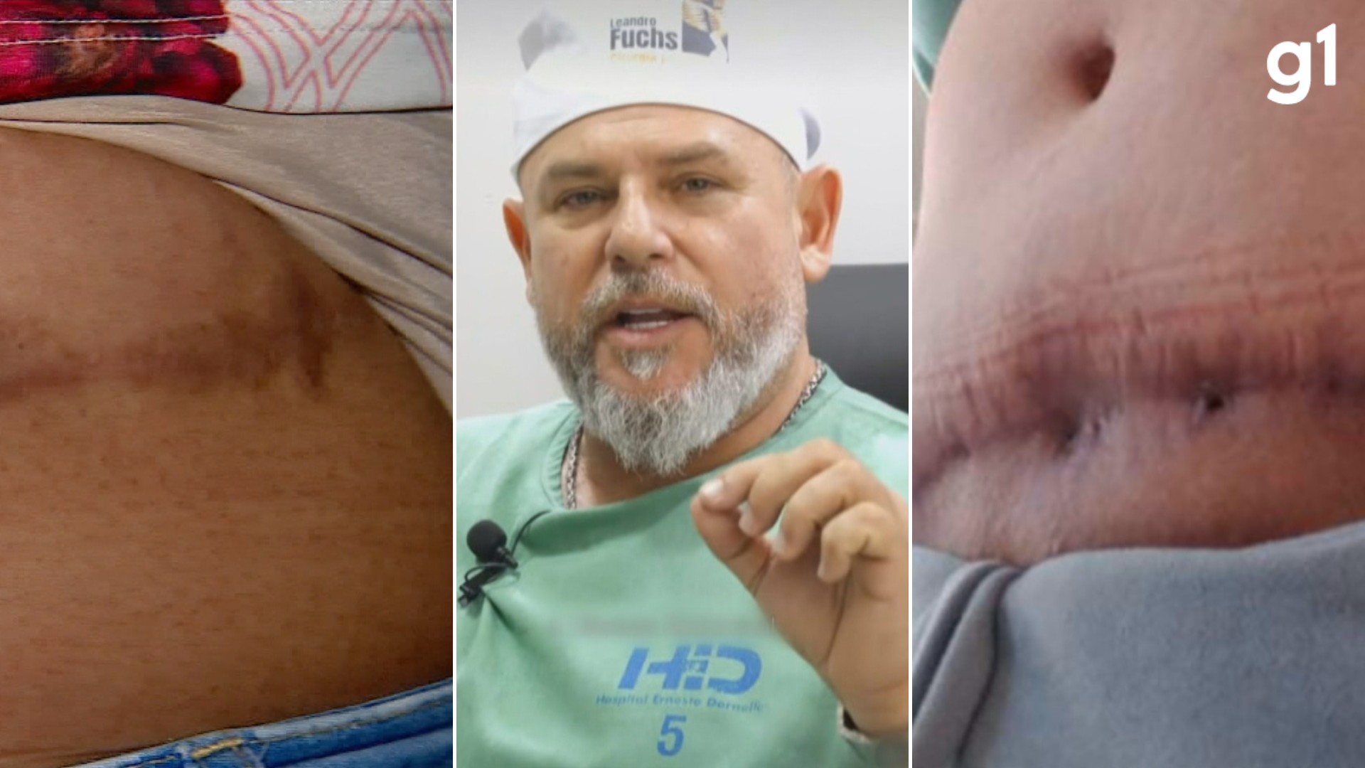 'Me sinto como se fosse um lixo', diz paciente de cirurgião plástico réu acusado de quatro tipos de crime ao operar mulheres