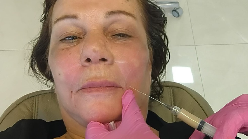 Polícia investiga morte de Silvana de Bruno depois de ela fazer uma série de procedimentos estéticos — Foto: Reprodução