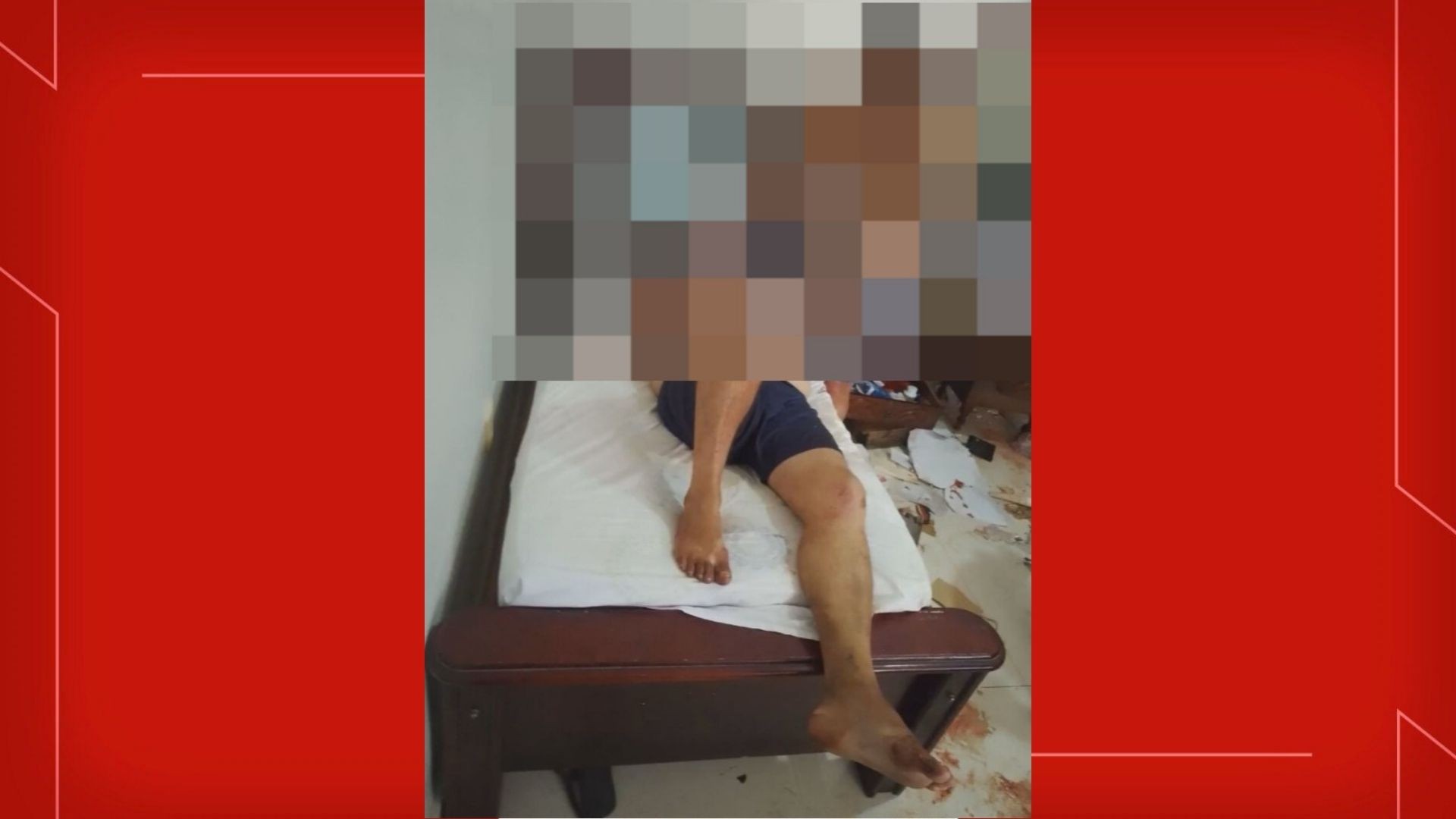 Homem de 55 anos espancado e mantido em cárcere privado no DF está na UTI