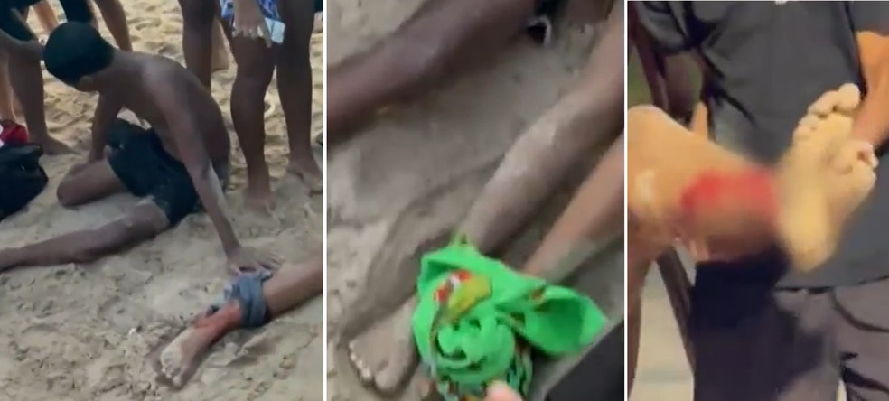 Banhistas foram atacados por cardume de peixe-espada em Rio das Ostras — Foto: Imagens cedidas Rio das Ostras em Foco