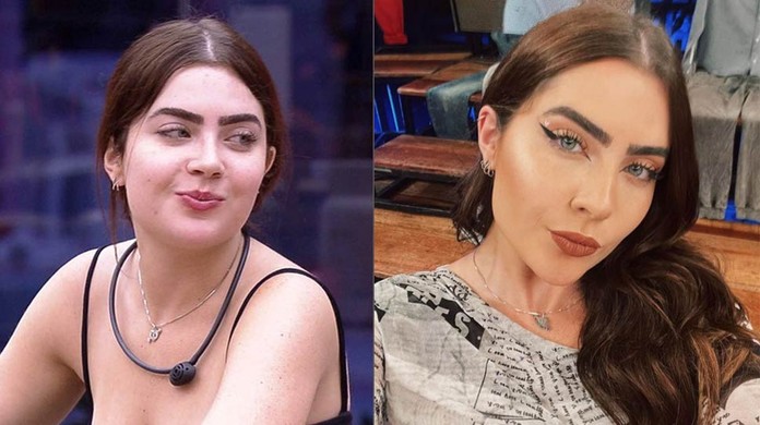 Rosto De Hipotireoidismo Antes E Depois Hipotireoidismo Congênito: