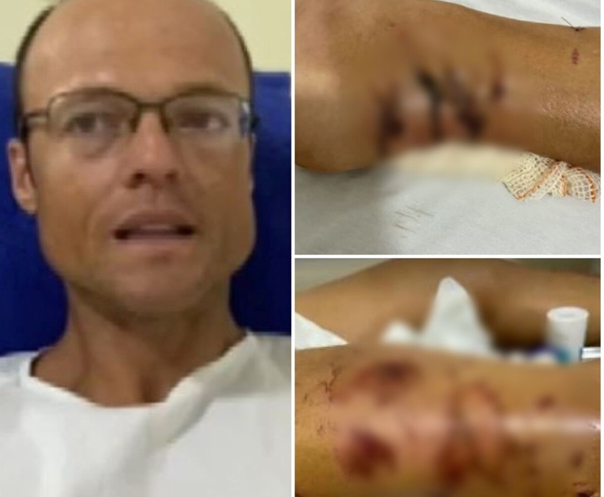 Quatro são condenados a indenizar em R$ 158,1 mil triatleta que levou mais de 50 mordidas de pitbulls