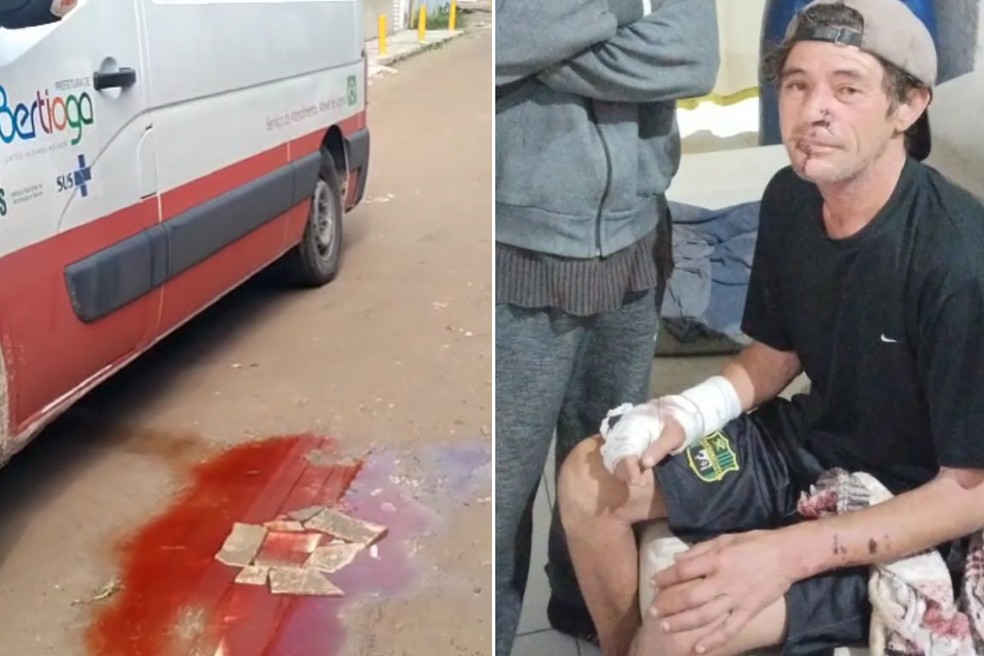Homem foi atacado por pitbull na última sexta-feira (21), no bairro Chácara Vista Linda, em Bertioga (SP) — Foto: Reprodução e Jaqueline Reis
