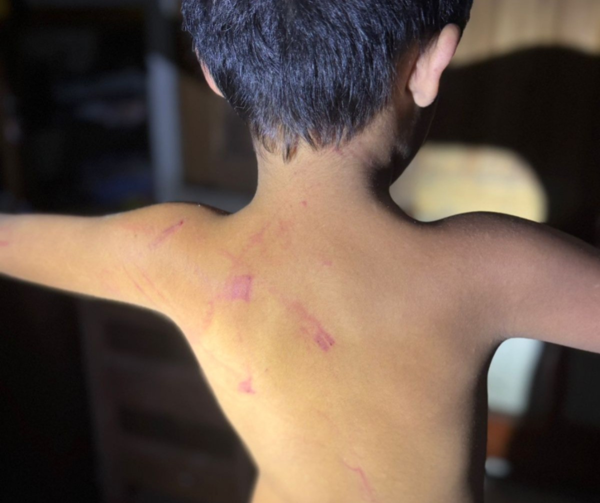 Mulher é presa após chicotear filhos com fio elétrico na Grande Belém; um deles é um bebê de 1 ano