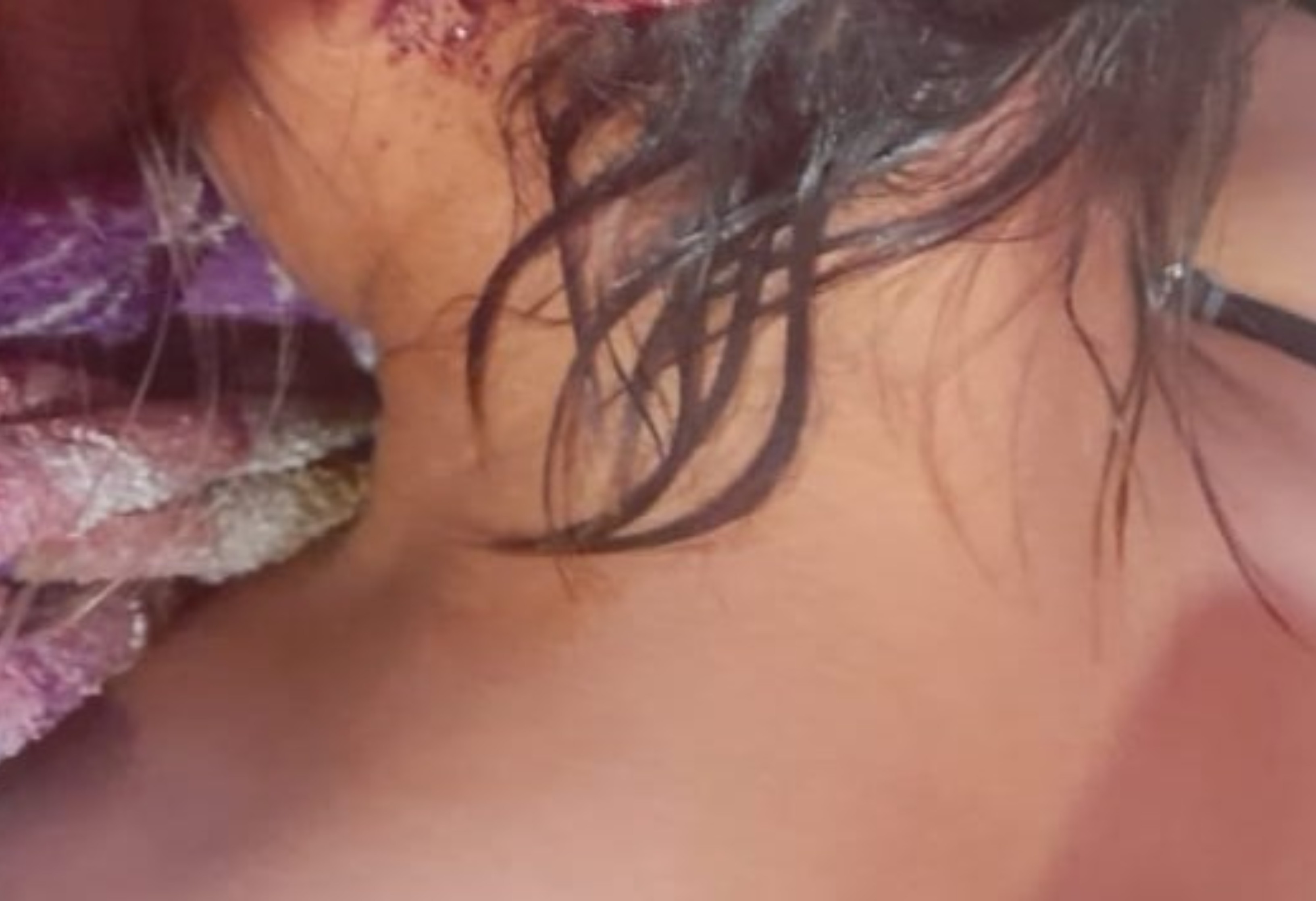 Adolescente é atacada com facão na nuca em comunidade no Bonfim, ao Norte de Roraima