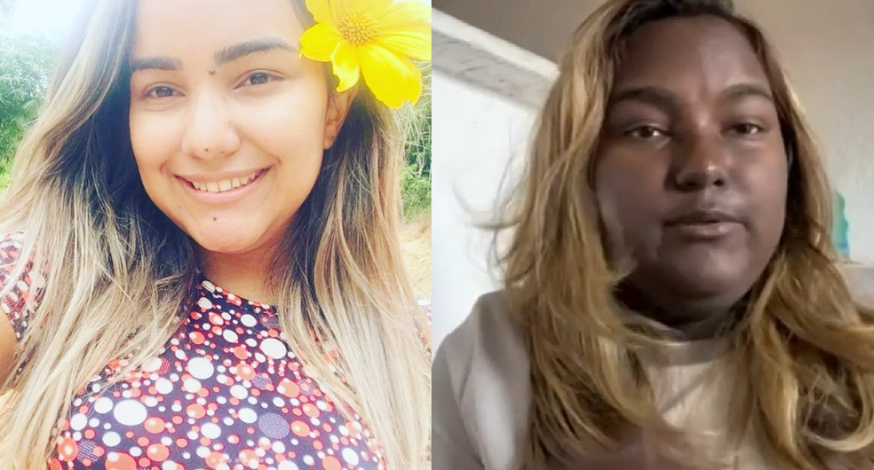Sabrina Gomes, jovem do Ceará tem tumor e síndrome que fazem mudar cor da pele — Foto: Reprodução/Instragram e Reprodução/TV Verdes Mares