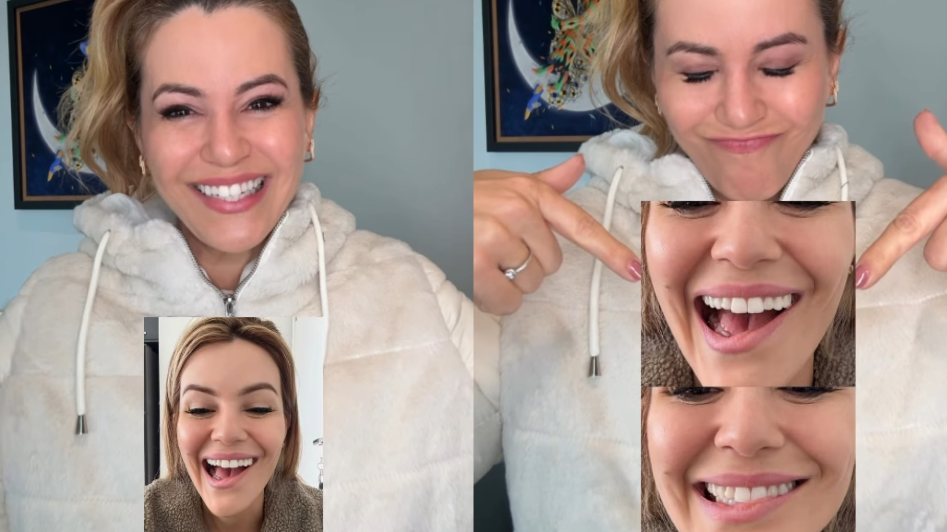 Musa do Carnaval de SP revela que teve nervo facial afetado após retirada de tumor na tireoide