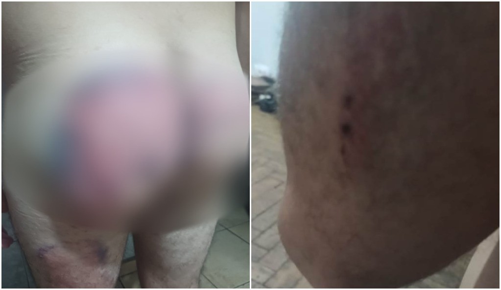 Soldado que denunciou agressão em quartel em SP está abalado e tomando calmantes, diz advogado: 'Trauma muito grande'