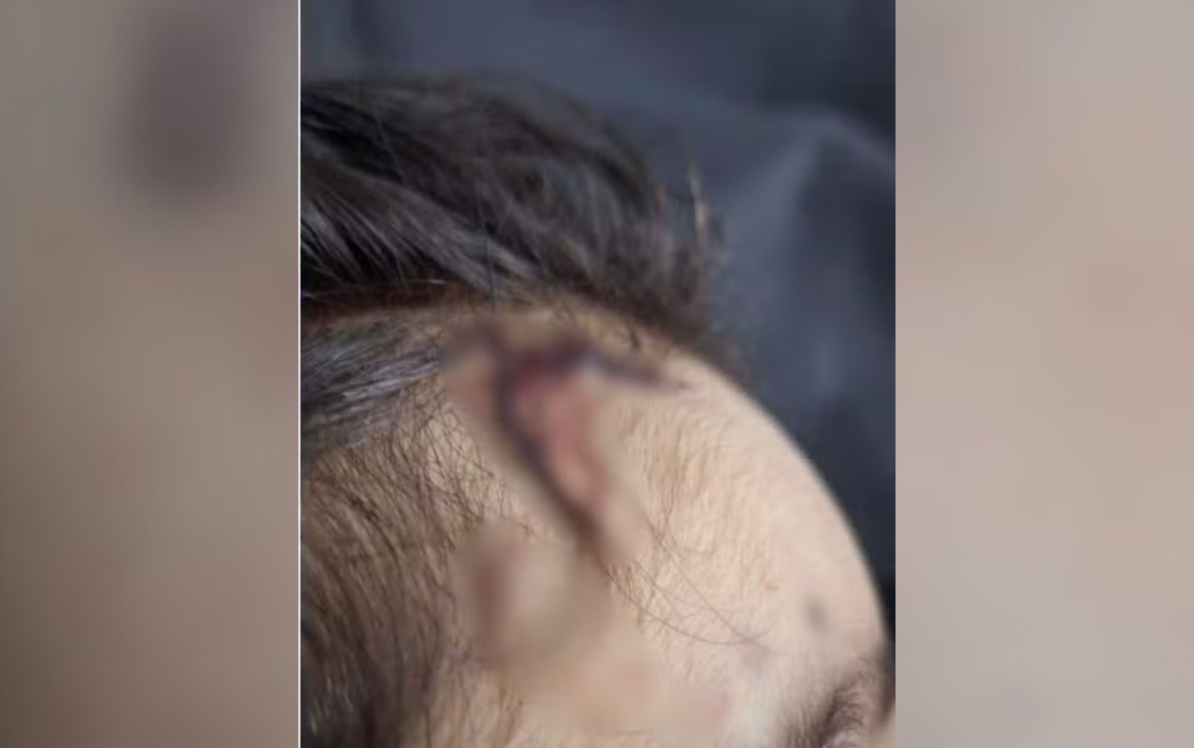 Casa foi lavada e criança arrastada após espancamento, diz delegado