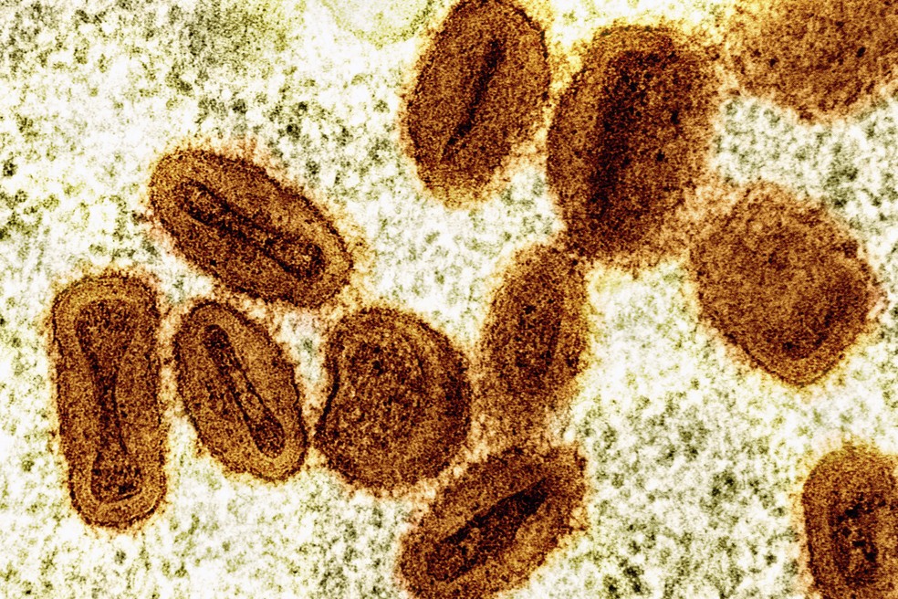 Imagem de microscpio eletrnico mostra partculas do vrus da mpox, em laranja, encontradas dentro de clulas infectadas, em verde.  Foto: NIAID