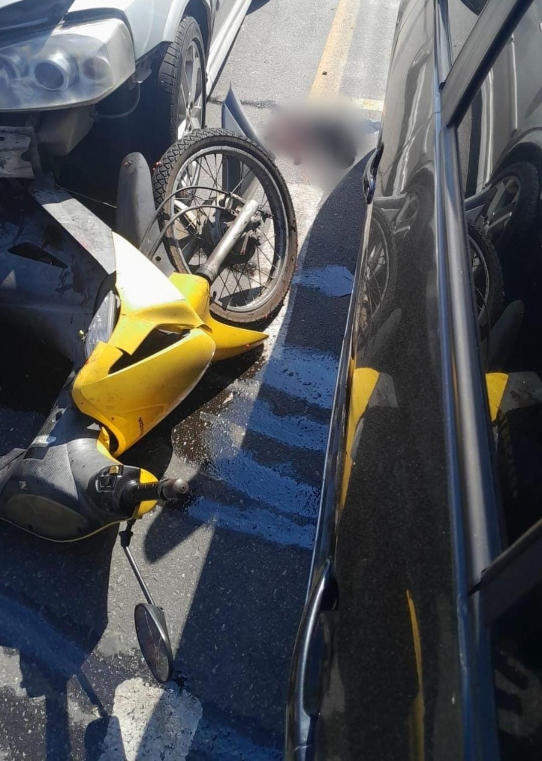 Motociclista tem pé amputado após colisão com carro em Resende