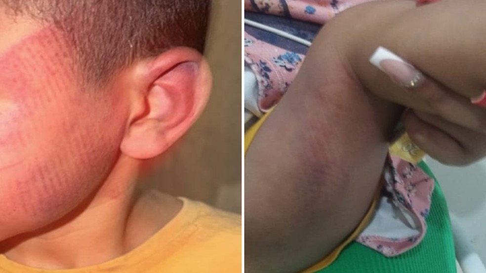Crianças ficaram com marcas de chinelada após serem agredidas pelo pai em Rio Preto (SP) — Foto: Arquivo pessoal
