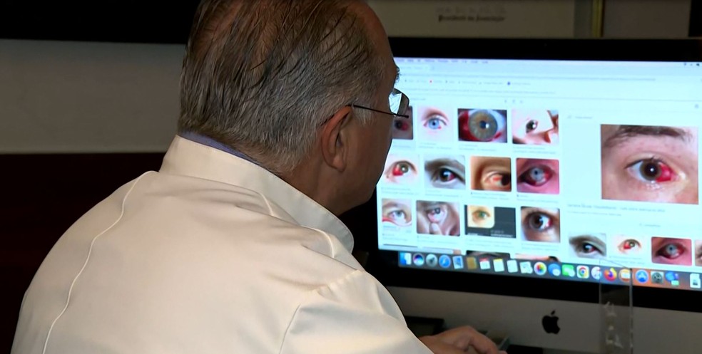Pacientes foram atendidos com dengue nos olhos em Campinas — Foto: Reprodução/EPTV