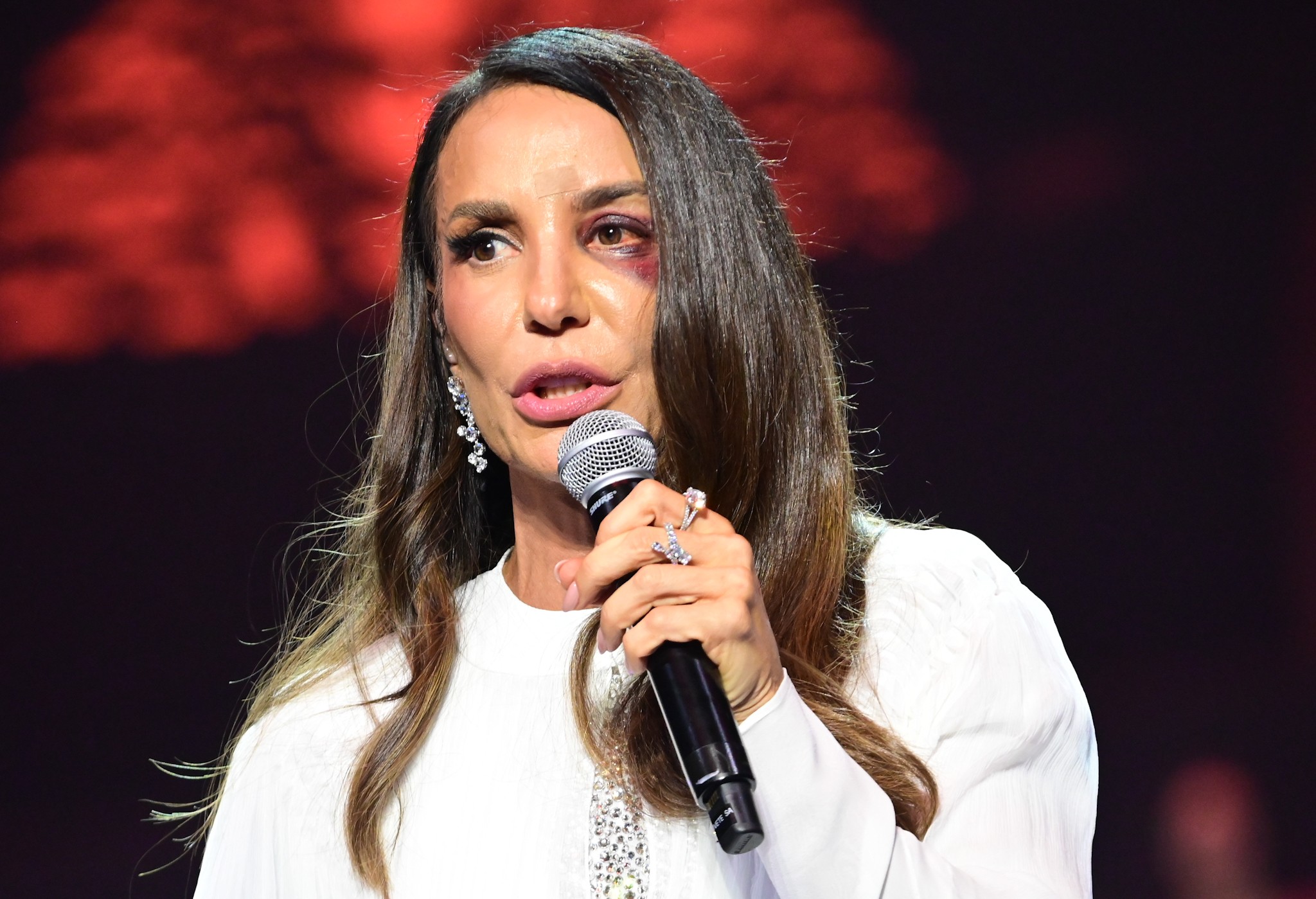 Ivete Sangalo revela que passará por cirurgia neste domingo