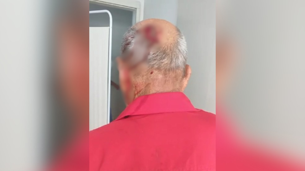 Aposentado leva pontos na cabeça após ser atacado e mordido por cachorros em Paranapuã (SP) — Foto: Arquivo pessoal