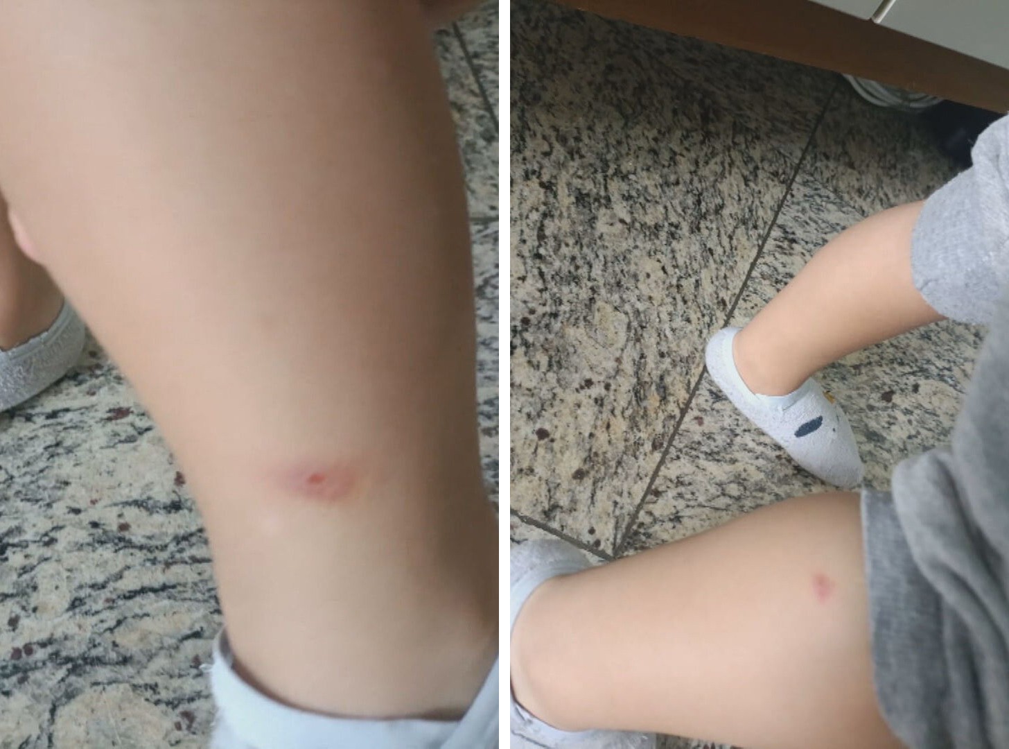 Pais denunciam infestação de piolhos e carrapatos em creche em Botafogo