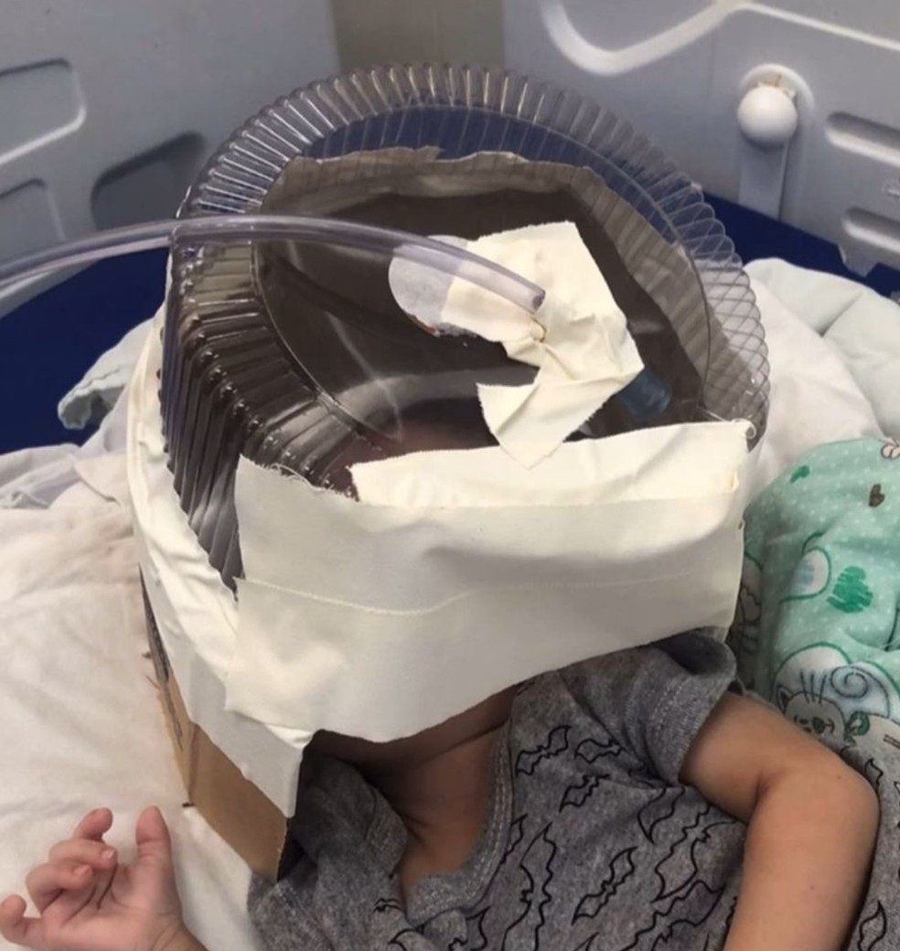 Hospital usa embalagem de bolo como máscara de oxigênio em bebê de 3 meses — Foto: Reprodução
