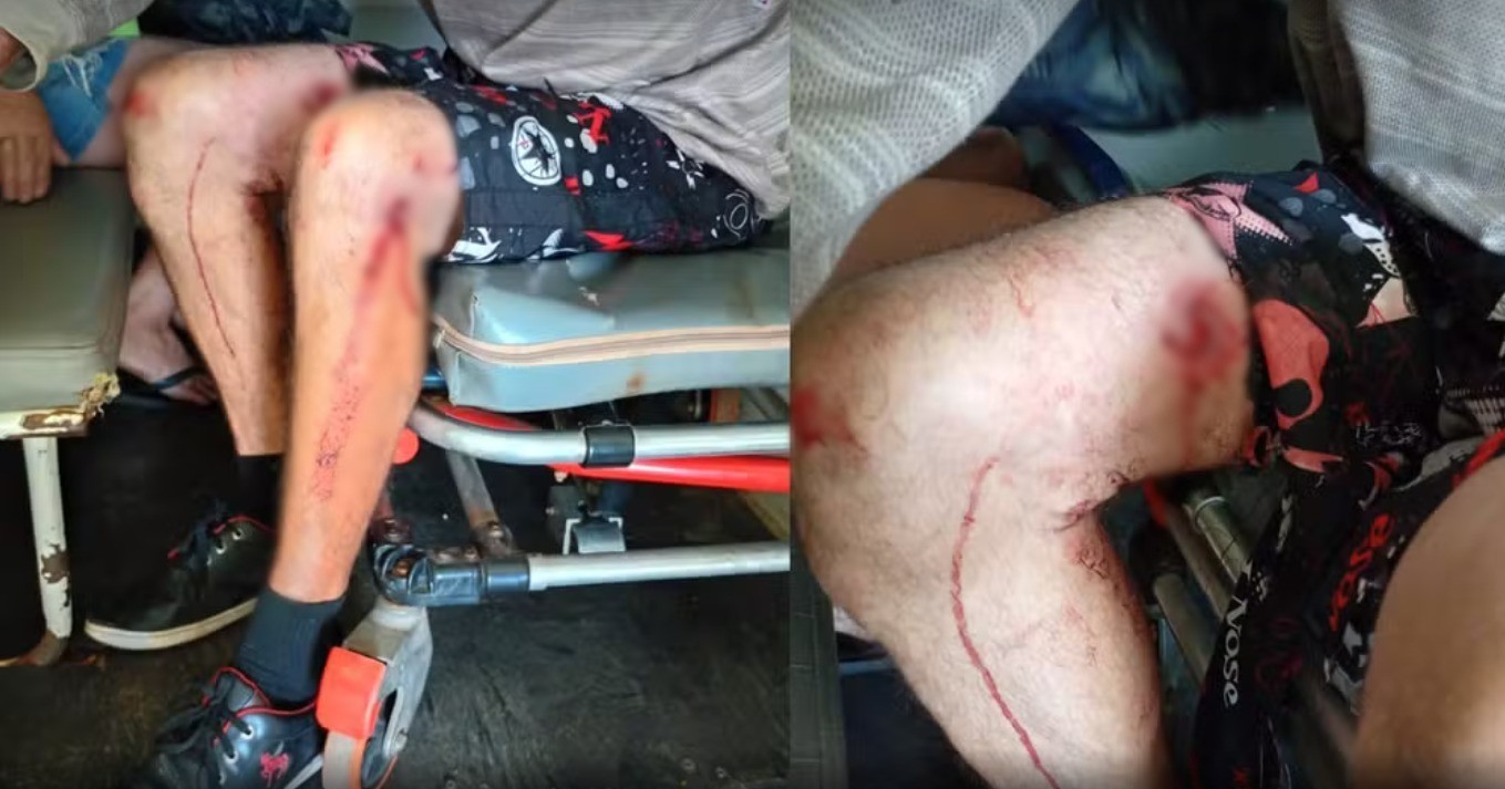 VÍDEO: homem é socorrido com ferimentos graves após ser atacado por pitbull em Cesário Lange