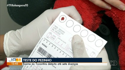 Teste do pezinho identifica somente sete doenças no Tocantins; Entenda