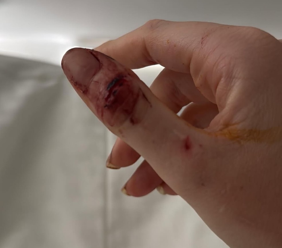 Imagem postada pela modelo Marcela Tomaszewski em desabafo publicado nas redes sociais na manhã desta quarta-feira (3) — Foto: Reprodução/ Instagram