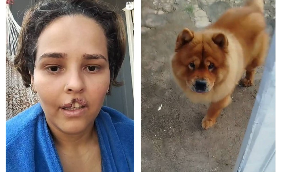 Natani Santos (à esquerda) depois da mordida do seu cachorro Jacke, de 5 anos (à direita), que não vive mais com ela — Foto: redes sociais