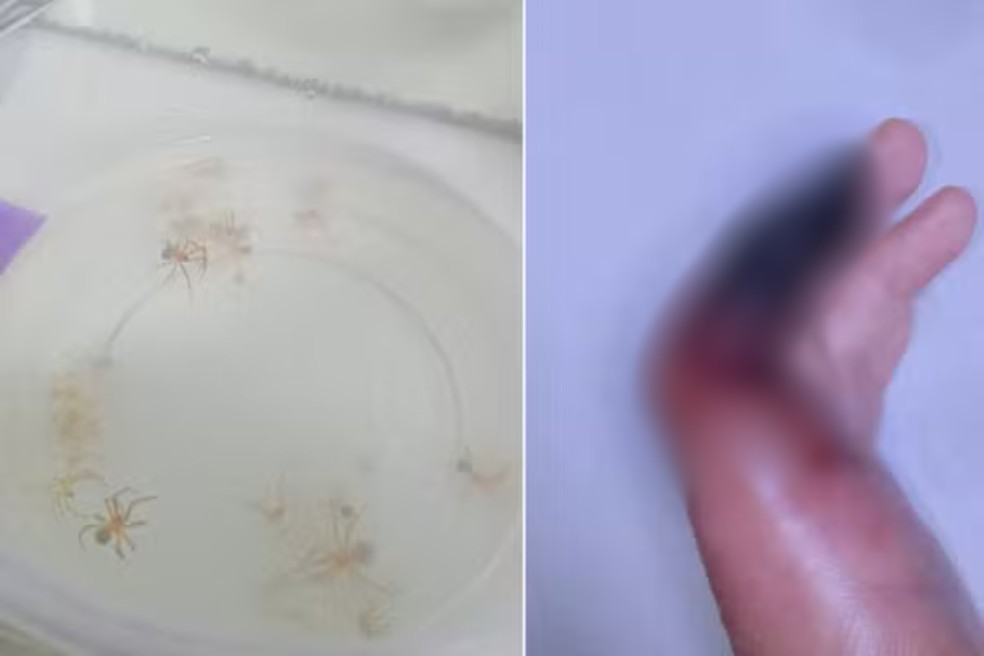 Garçom encontrou algumas aranhas-marrons em casa após ter sido picado enquanto dormia em Praia Grande (SP) — Foto: Arquivo pessoal