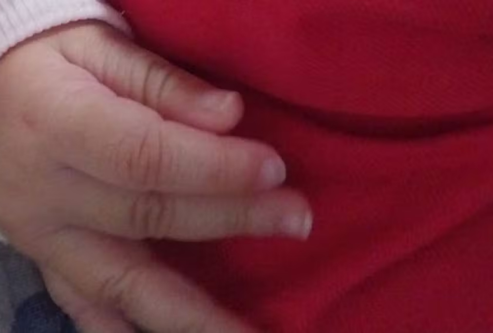Bebê de 7 meses é internado com costela quebrada e lesão no crânio; mãe é presa em MS