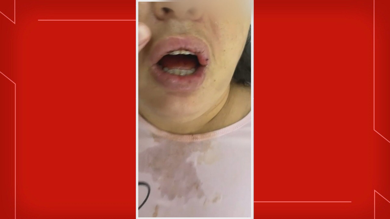 Família denuncia que paciente sofreu agressões e tortura em clínica psiquiátrica no DF