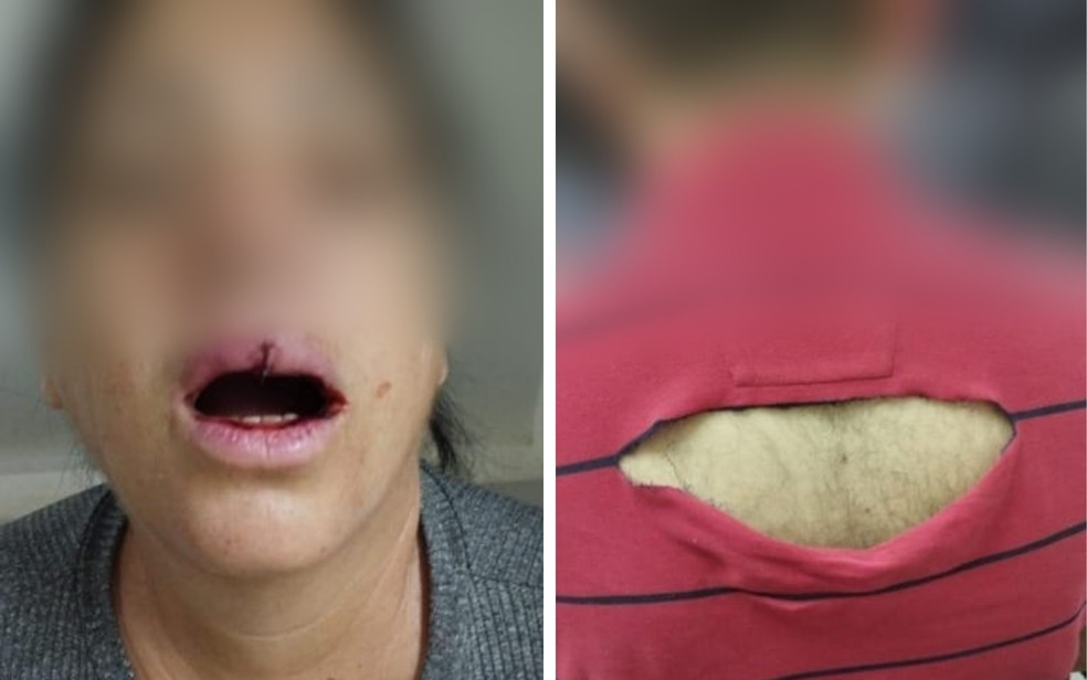 Em meio a confusão, a avó denunciou à polícia que o médico deu um soco na boca dela. — Foto: Reprodução/Polícia Civil