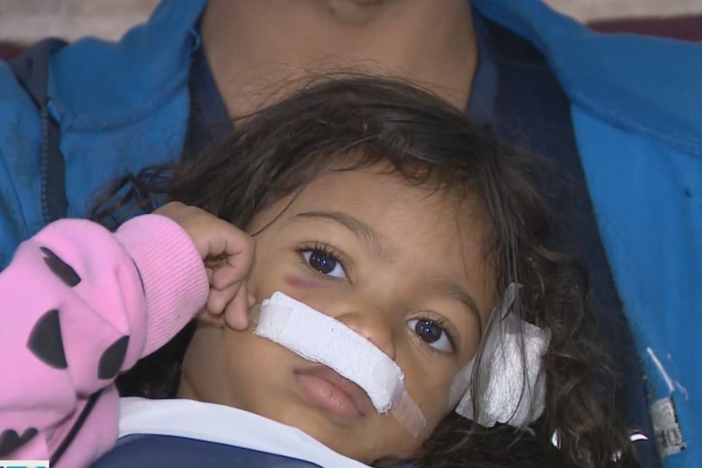 Pitbull ataca três crianças dentro de condomínio em Monte Mor; pais relatam momentos — Foto: Reprodução/EPTV