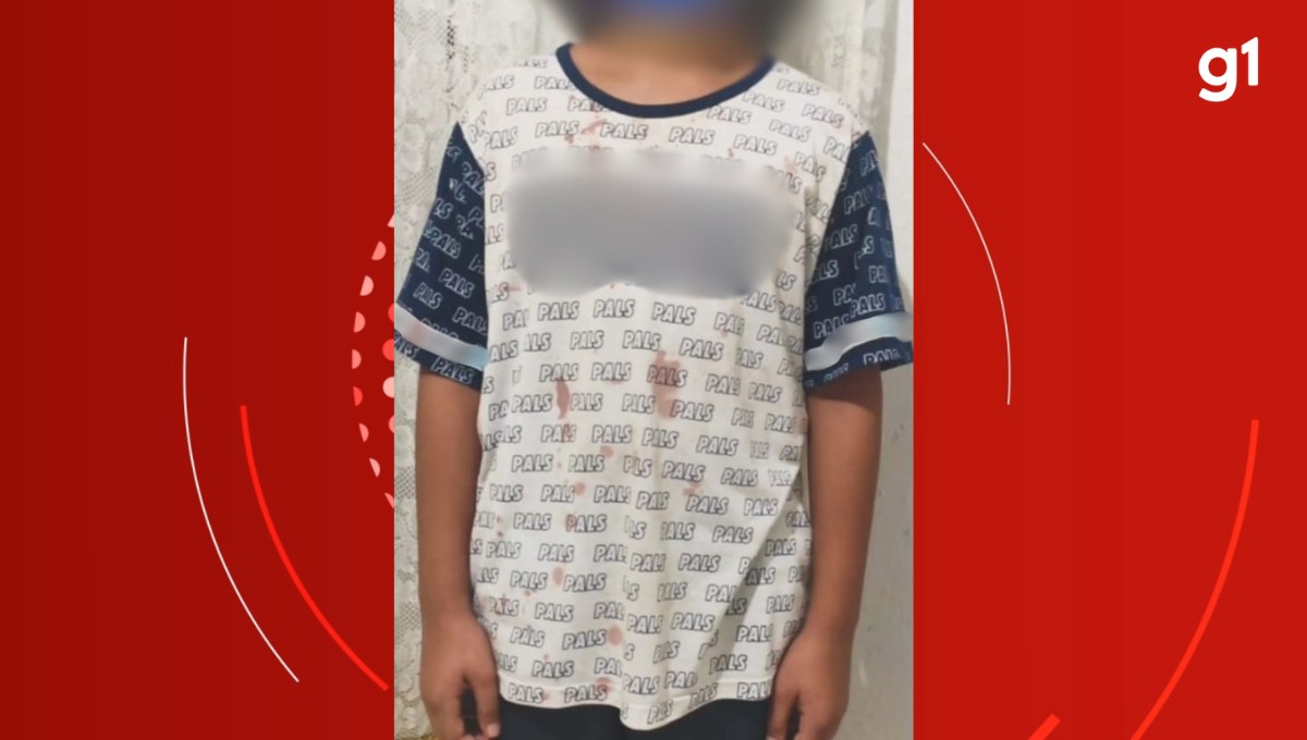 Polícia investiga denúncia de agressão a aluno autista em escola de Timóteo