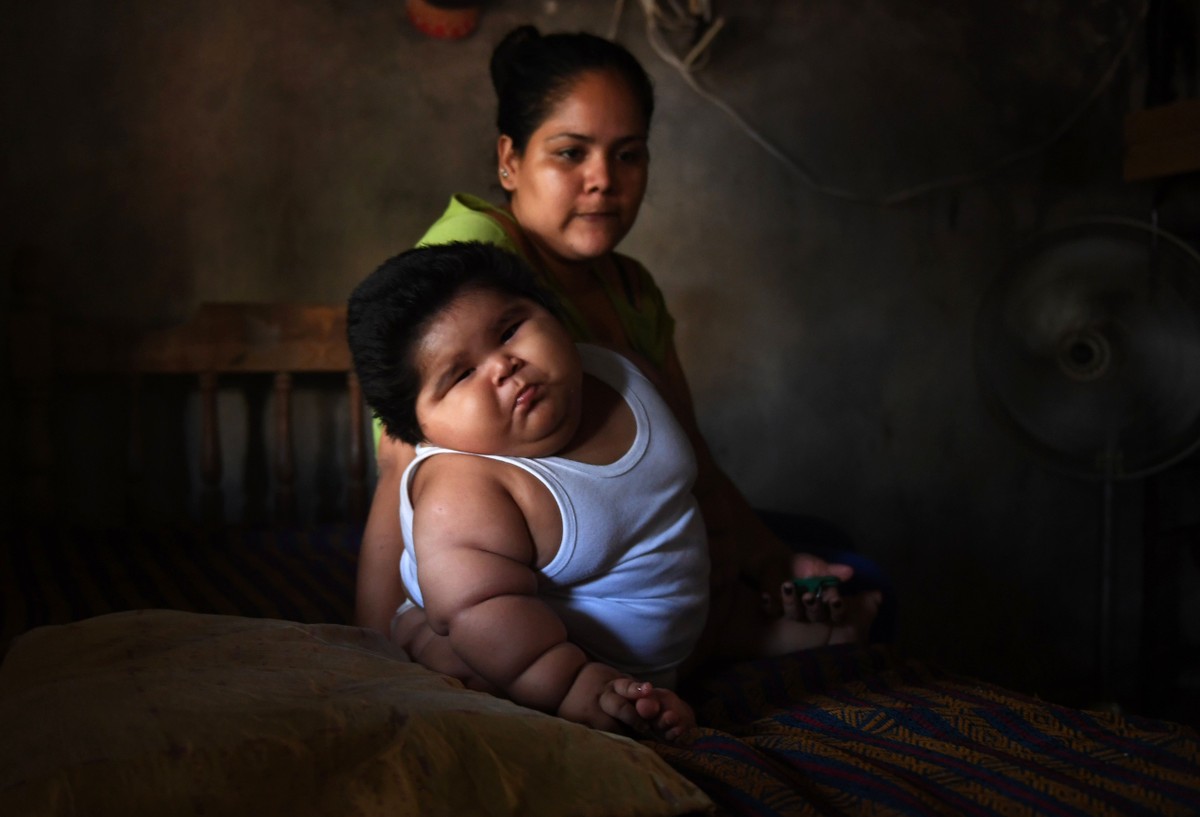 O que é a inflamação rara que fez bebê mexicano chegar aos 28 kg com dez meses de idade