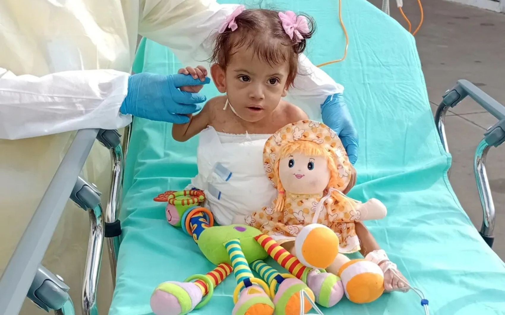 Siamesa de SP que foi separada em Goiânia passa por cirurgia e está na UTI