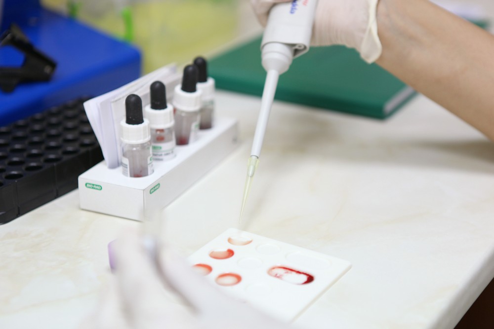 Exames de sangue identificam alterações ligadas ao Alzheimer anos antes do surgimento de sintomas cognitivos