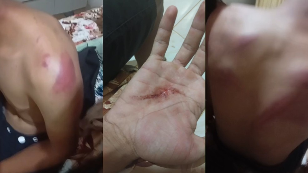 Família filmou lesões em jovem que teria sido agredido por PMs em Capistrano (CE). — Foto: Reprodução
