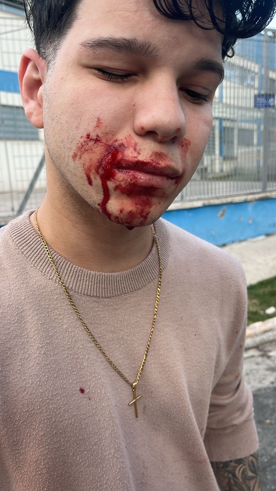 'A janela explodiu na minha cara': jovem fica ferido após explosão atingir imóveis no Jaguaré