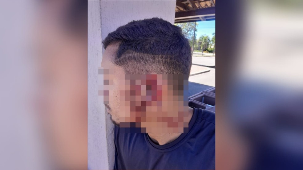 Homem morde e arranca pedaço de orelha de entregador durante discussão iniciada por política, no Ceará. — Foto: Reprodução