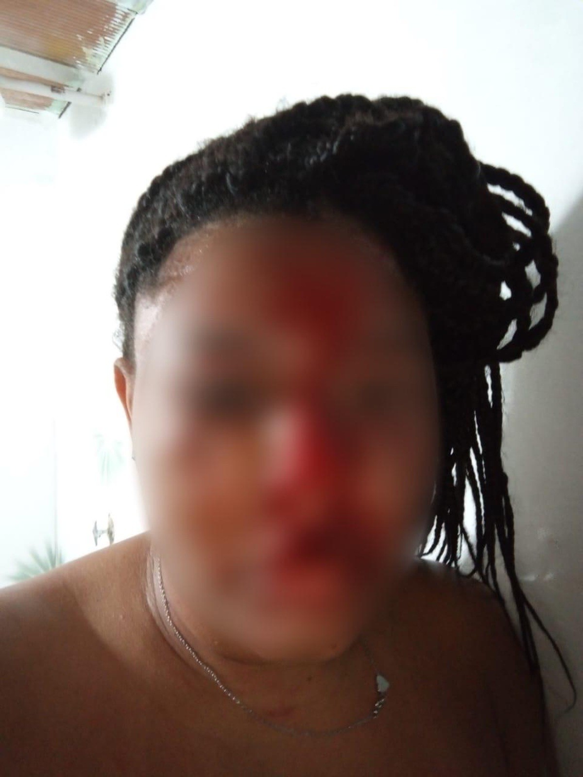 Mulher é agredida pelo ex-companheiro dentro de casa em Araruama