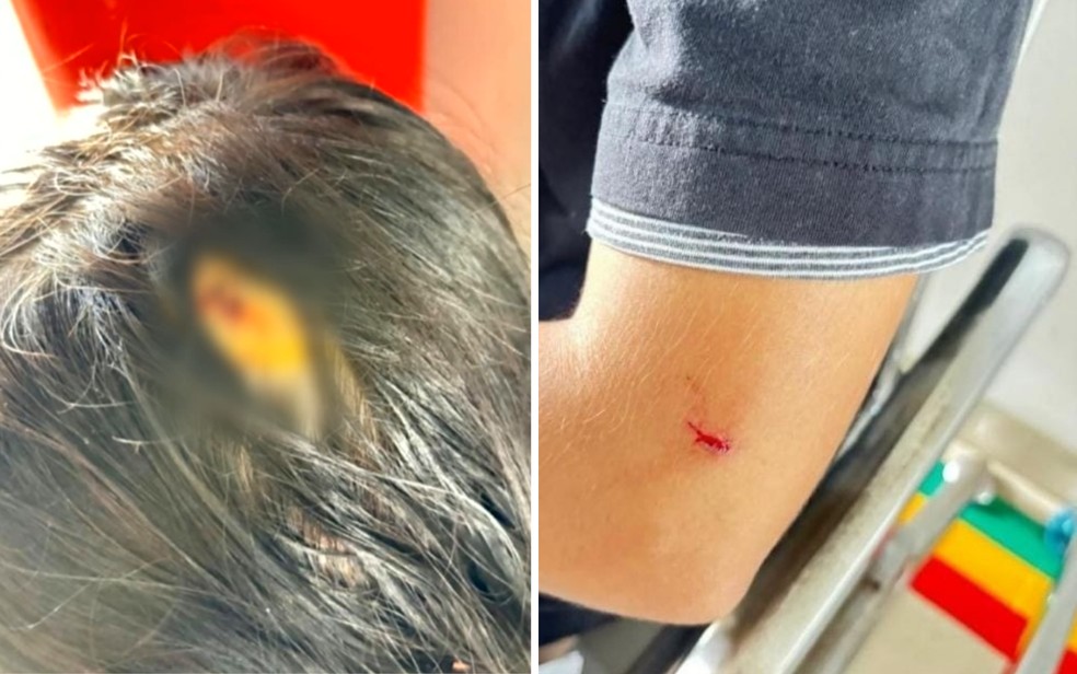 Adolescente teve ferimentos na cabeça e no braço — Foto: Polícia Militar / Reprodução