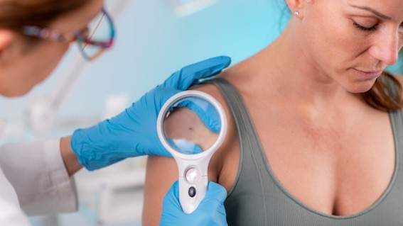 Unimed Cuiabá reforça que forma de evitar o câncer de pele é se proteger do sol