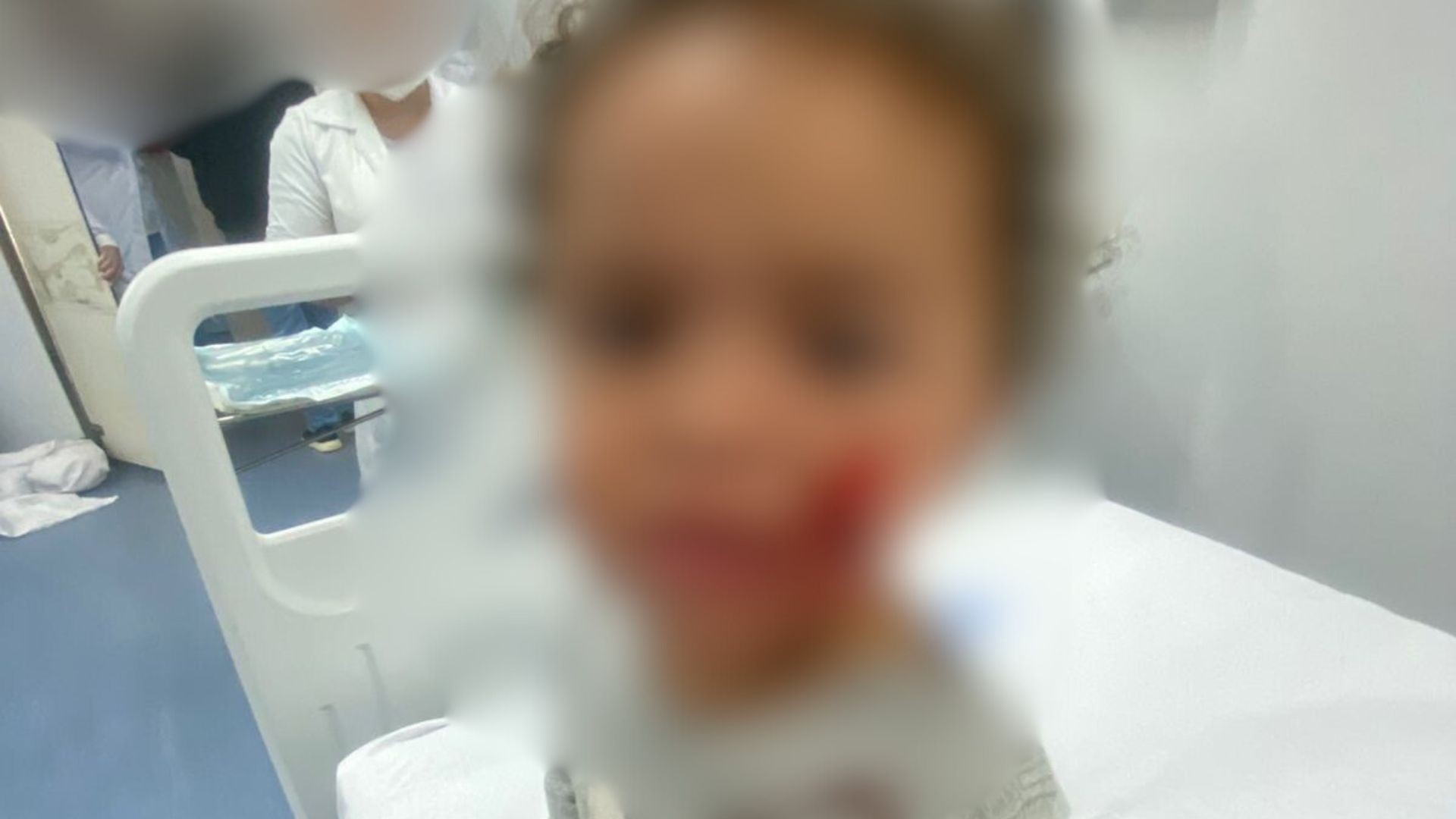 Bebê de 1 ano e 7 meses é atacado por pitbull enquanto brincava em calçada no ES