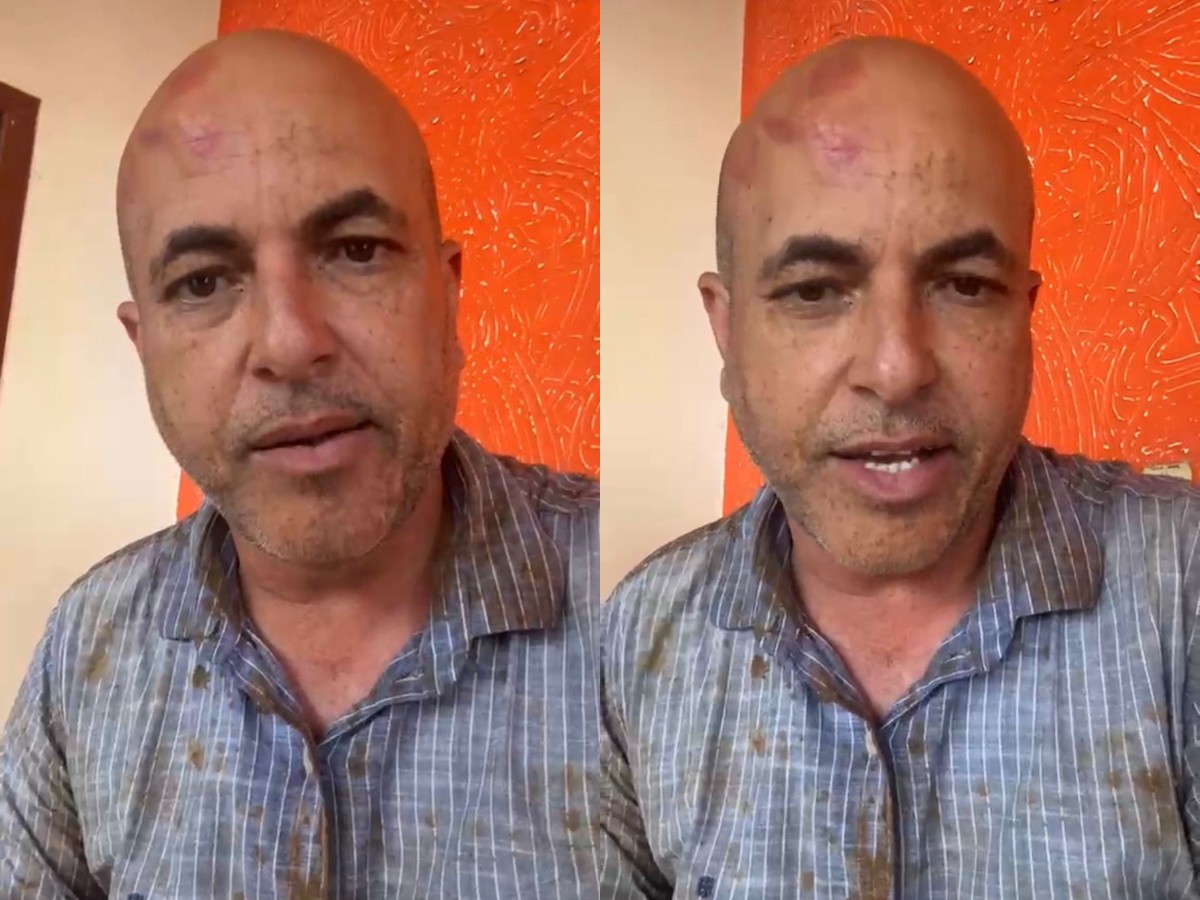 Deputado Ismael Crispin sofre acidente após veículo aquaplanar na BR-429, em RO