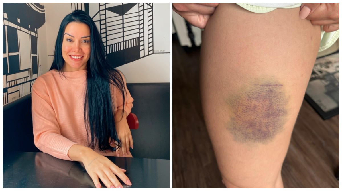 Nutricionista lutou por 13 minutos contra agressor que invadiu sua casa na Grande SP para estuprá-la: 'Briguei pela vida' 
