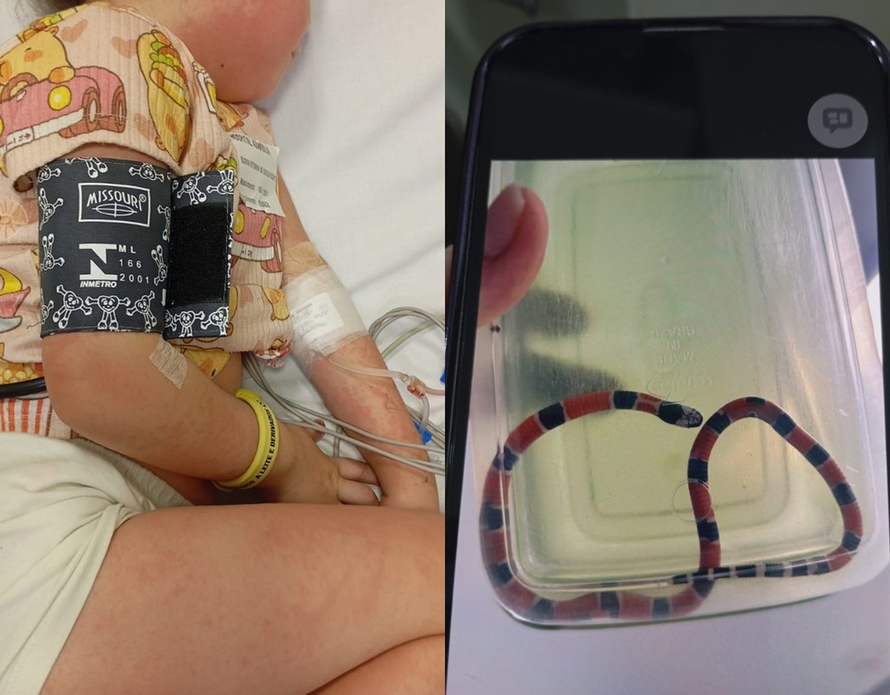 Menina de 4 anos sobrevive a choques anafil&aacute;ticos ap&oacute;s picada de cobra-coral &mdash; Foto: Arquivo pessoal