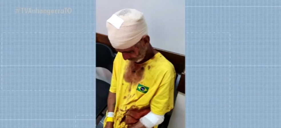 Homem de 20 anos ficou ferido na briga  Foto: Divulgação