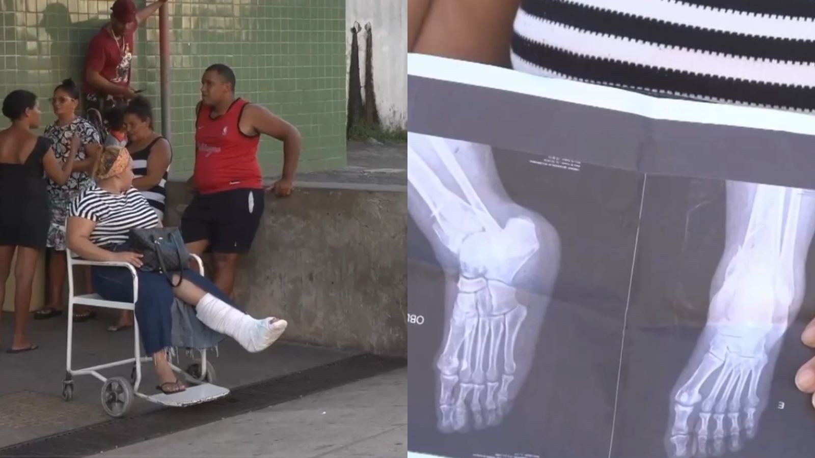 Confeiteira aguarda cirurgia há nove dias e denuncia superlotação em UPA de Teresina